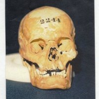 Skull of Lewis Thornton Powell